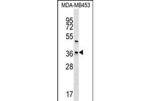 UBE2Z Antibody (C-term) (ABIN1537034 and ABIN2848865) western blot analysis in MDA-M cell line lysates (35 μg/lane). (UBE2Z anticorps  (C-Term))