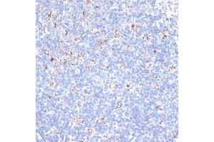 Immunohistochemistry of paraffin-embedded mouse spleen using KCNS3 antibody (ABIN6132153, ABIN6142774, ABIN6142775 and ABIN6223897) at dilution of 1:100 (40x lens).