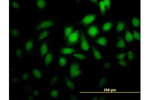 Image no. 5 for anti-Protein Geranylgeranyltransferase Type I, beta Subunit (PGGT1B) (AA 1-106) antibody (ABIN598867) (PGGT1B anticorps  (AA 1-106))