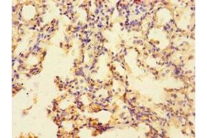 Immunohistochemistry of paraffin-embedded human lung tissue using ABIN7170239 at dilution of 1:100 (SLC35F6 anticorps  (AA 337-371))