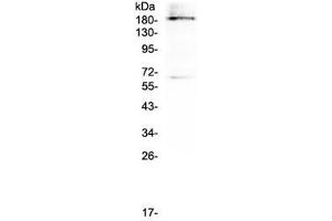 Western blot testing of human U937 cell lysate with Dnmt1 antibody at 0. (DNMT1 anticorps)