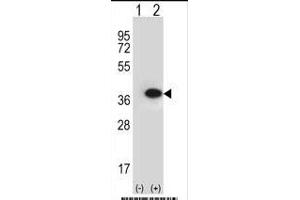 Western blot analysis of ANXA2 (arrow) using rabbit polyclonal ANXA2 Antibody (N-term) (ABIN391619 and ABIN2841538). (Annexin A2 anticorps  (N-Term))