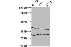 Western Blot Positive WB detected in: HL60 whole cell lysate, 293 whole cell lysate, K562 whole cell lysate All lanes: DMRT1 antibody at 1:2000 Secondary Goat polyclonal to rabbit IgG at 1/50000 dilution Predicted band size: 40, 29, 19 kDa Observed band size: 40 kDa (DMRT1 anticorps  (AA 195-363))