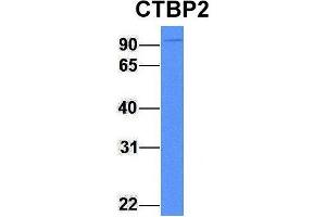 Host:  Rabbit  Target Name:  CTBP2  Sample Type:  Human Fetal Brain  Antibody Dilution:  1. (CTBP2 anticorps  (C-Term))
