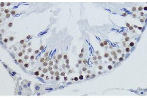 Immunohistochemistry of paraffin-embedded Rat testis using DiMethyl-Histone H4-K20 Polyclonal Antibody at dilution of 1:200 (40x lens). (Histone H4 anticorps  (2meLys20))