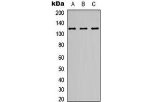 Western blot analysis of NMDAR1 expression in A549 (A), Y79 (B), Raji (C) whole cell lysates. (GRIN1/NMDAR1 anticorps  (C-Term))