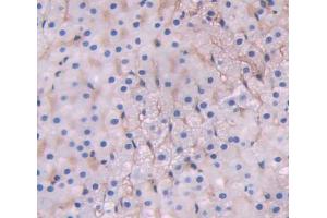 Used in DAB staining on fromalin fixed paraffin- embedded adrenal gland tissue