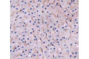 Used in DAB staining on fromalin fixed paraffin- embedded adrenal gland tissue (ABCD1 anticorps  (AA 102-386))