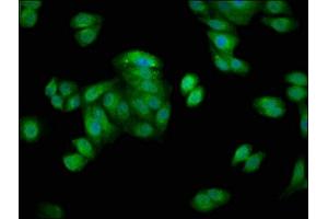 Immunofluorescence staining of HepG2 cells with ABIN7154867 at 1:66, counter-stained with DAPI. (HSP70 1A anticorps  (AA 418-512))
