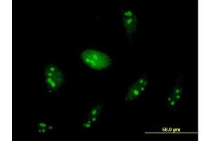 Immunofluorescence of purified MaxPab antibody to WDR74 on HeLa cell. (WDR74 anticorps  (AA 1-366))