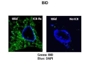 Sample Type: Rat thyrocytes-FRTL-5  Primary Antibody Dilution: 1:100 Secondary Antibody: Anti-rabbit-FITC  Secondary Antibody Dilution: 1:000 Color/Signal Descriptions: Green: BIDBlue: DAPI  Gene Name: BID Submitted by: Syed A Morshed, Mount Sinai School of Medicine and James J Peters VA Medical Center