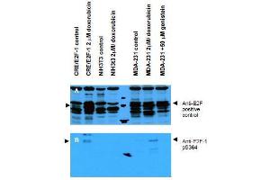 Image no. 1 for anti-E2F Transcription Factor 1 (E2F1) (AA 360-369), (pSer364) antibody (ABIN401277)