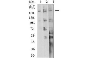 Western blot analysis using CD104 mouse mAb against A549 (1), A431 (2), and SW620 (3) cell lysate.