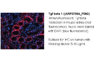 Image no. 2 for anti-Transforming Growth Factor, beta 1 (TGFB1) (Middle Region) antibody (ABIN2780306) (TGFB1 anticorps  (Middle Region))