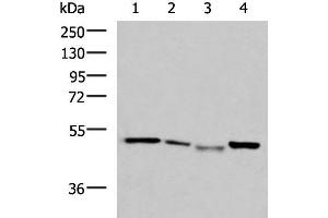 Western blot analysis of HepG2 cell Hela cell Mouse kidney tissue K562 cell lysates using NFS1 Polyclonal Antibody at dilution of 1:800 (NFS1 anticorps)