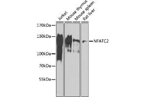 Western blot analysis of extracts of various cell lines, using NF antibody (ABIN6130583, ABIN6144556, ABIN6144557 and ABIN6218469) at 1:1000 dilution. (NFAT1 anticorps  (AA 1-300))