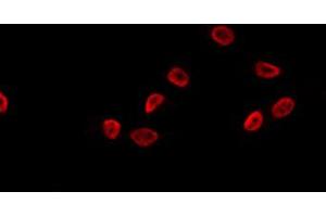 ABIN6274090 staining K562 by IF/ICC. (OVOL1 anticorps  (N-Term))