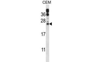 Western Blotting (WB) image for anti-RAB6B, Member RAS Oncogene Family (RAB6B) antibody (ABIN2997576) (RAB6B anticorps)