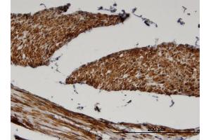 Immunoperoxidase of monoclonal antibody to FADS1 on formalin-fixed paraffin-embedded human skeletal muscle.