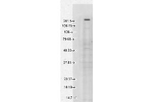 Western Blot analysis of Human Cell lysates showing detection of TrpM7 protein using Mouse Anti-TrpM7 Monoclonal Antibody, Clone S74-25 . (TRPM7 anticorps  (AA 1817-1863) (Atto 594))