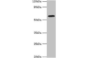 Western blot All lanes: STXBP4 antibody at 10 μg/mL + PC-3 whole cell lysate Secondary Goat polyclonal to rabbit IgG at 1/10000 dilution Predicted band size: 62, 27 kDa Observed band size: 62 kDa (STXBP4 anticorps  (AA 344-553))
