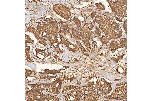 IHC analysis of SCO1 using anti-SCO1 antibody (ABIN7600609). (SCO1 anticorps  (AA 21-301))