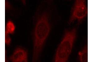 Immunofluorescence staining of methanol-fixed HeLa cells using Phospho-eIF2α-S51 antibody (ABIN2987989). (EIF2S1 anticorps  (pSer51))