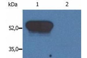 Western Blotting (WB) image for anti-Glial Fibrillary Acidic Protein (GFAP) antibody (ABIN238409) (GFAP anticorps)