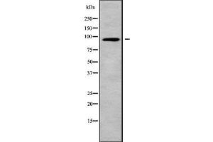 Western blot analysis of CNGB3 using A549 whole cell lysates (CNGB3 anticorps  (N-Term))