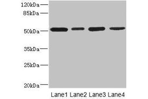 Western blot All lanes: CD276 antibody at 0. (CD276 anticorps  (AA 29-200))