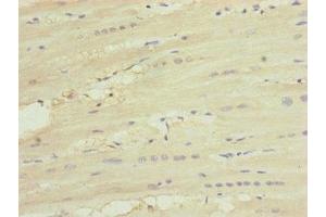 Immunohistochemistry of paraffin-embedded human heart tissue using ABIN7174236 at dilution of 1:100 (MNF1 anticorps  (AA 14-126))