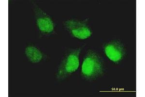 Immunofluorescence of monoclonal antibody to CASP14 on HeLa cell.