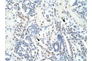 POGZ antibody was used for immunohistochemistry at a concentration of 4-8 ug/ml to stain EpitheliaI cells of renal tubule (arrows) in Human Kidney. (POGZ anticorps  (N-Term))