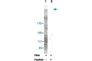 Western blot analysis of extracts from NIH/3T3 cells, treated with PMA (125 ng/ml, 30 mins), using ACACA polyclonal antibody . (Acetyl-CoA Carboxylase alpha anticorps  (Ser79))
