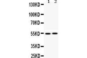 Anti- Vimentin Picoband antibody, Western blottingAll lanes: Anti Vimentin  at 0. (Vimentin anticorps  (C-Term))