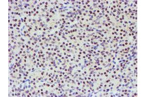 Image no. 3 for anti-TP53RK Binding Protein (TPRKB) antibody (ABIN1501485) (TPRKB anticorps)