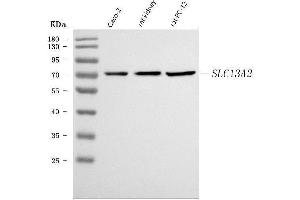 Western blot analysis of NaDC-1/SLC13A2 using anti-NaDC-1/SLC13A2 antibody (ABIN7600128).
