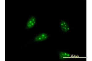 Immunofluorescence of monoclonal antibody to PTF1A on HeLa cell.