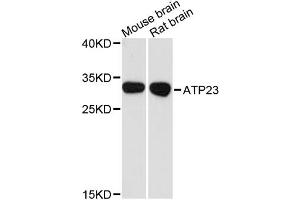 Western blot analysis of extracts of various cell lines, using ATP23 antibody. (XRCC6BP1 anticorps)