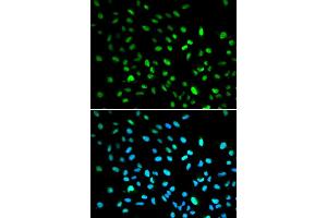 Immunofluorescence analysis of A549 cells using DDIT3 antibody (ABIN5973893). (DDIT3 anticorps)