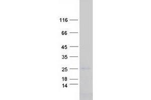 Validation with Western Blot