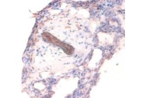 Immunohistochemistry of paraffin-embedded human lung tissue using ABIN7148208 at dilution of 1:100 (COL4A1 anticorps  (AA 30-167))