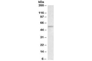 Western blot testing of rat thymus lysate with CHK1 antibody at 2ug/ml. (CHEK1 anticorps)