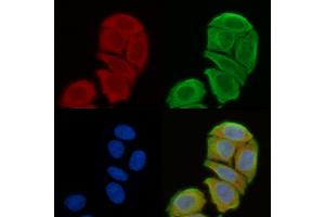 ABIN6258180 and ABIN6273874 staining Hela cells(45 min of heat-shock) by IF/ICC.