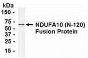 Western Blotting (WB) image for anti-NADH Dehydrogenase (Ubiquinone) 1 alpha Subcomplex, 10, 42kDa (NDUFA10) (AA 21-140) antibody (ABIN2468028) (NDUFA10 anticorps  (AA 21-140))
