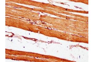 IHC image of ABIN7151067 diluted at 1:600 and staining in paraffin-embedded human skeletal muscle tissue performed on a Leica BondTM system. (MIB2 anticorps  (AA 1-128))
