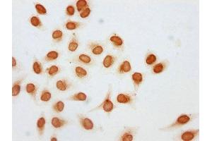 Immunocytochemistry analysis of ABIN7139195 diluted at 1:5 and staining in Hela cells (treated with 30mM sodium butyrate for 4h) performed on a Leica BondTM system.