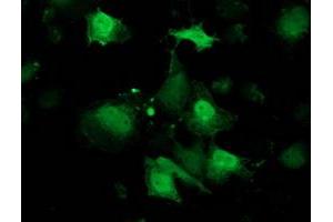 Anti-RBP1 mouse monoclonal antibody (ABIN2454467) immunofluorescent staining of COS7 cells transiently transfected by pCMV6-ENTRY RBP1 (RC214515). (RBP1 anticorps)