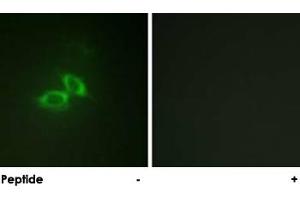Immunofluorescence analysis of NIH/3T3 cells, using GRIN1 polyclonal antibody .
