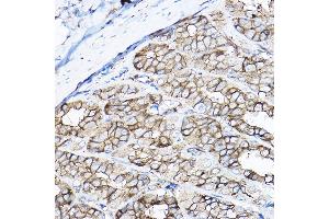 Immunohistochemistry of paraffin-embedded rat stomach using GNB2 Rabbit pAb  at dilution of 1:100 (40x lens). (GNB2 anticorps  (AA 1-340))